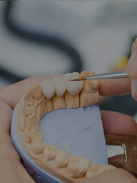 Hands using a fine brush to detail a dental bridge on a plaster model.